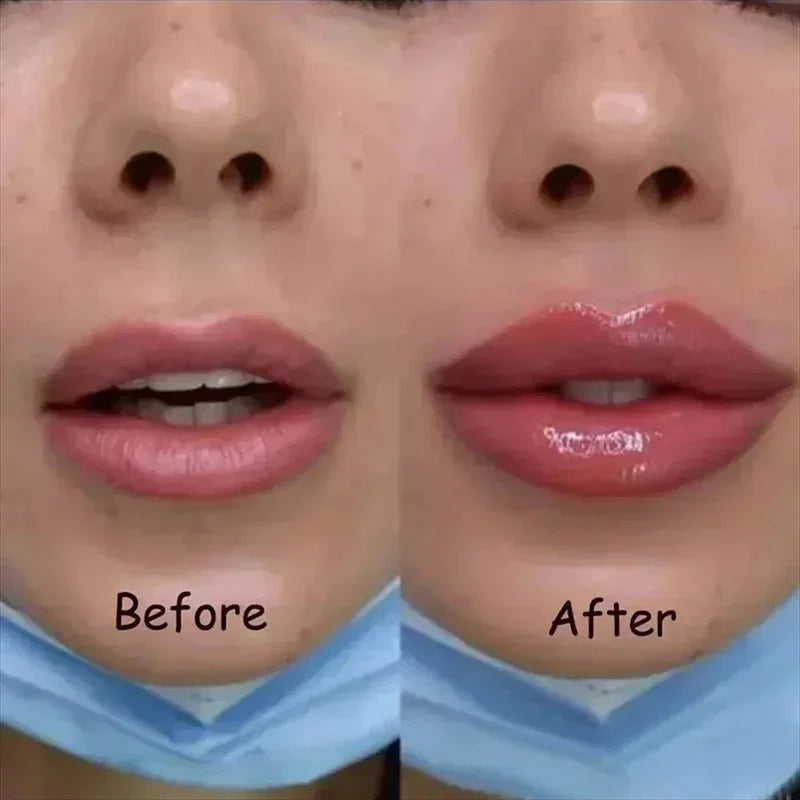 Hidratante labial aumento labial instantâneo